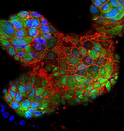 Placental cells grown in bioreactor Placental cells grown in bioreactor