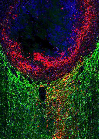 Axon regrowth through an astrocyte scar Axon regrowth through an astrocyte scar