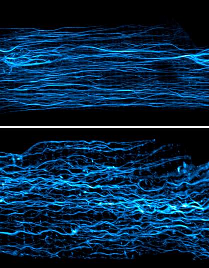 Fluorescent images of microtubules in heart cells. Top panel shows elongated microtubules; bottom panel shows microtubules buckling during contraction