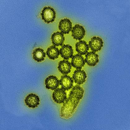 H1N1 Influenza Virus Particles Colorized electron micrograph of H1N1 influenza virus particles.