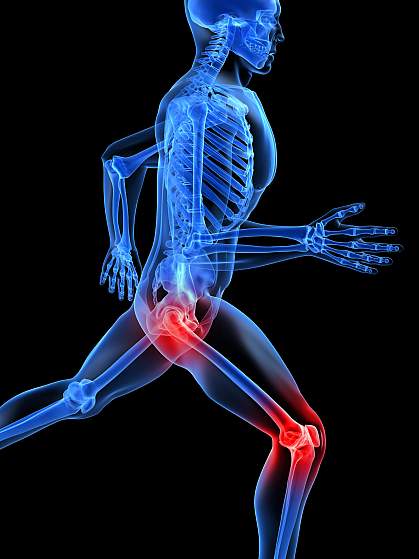 Illustration of human skeleton with hip and knee joints glowing red. Illustration of human skeleton with hip and knee joints glowing red.