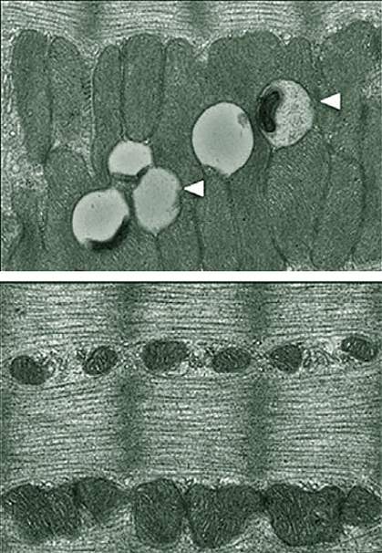 Electron microscopy images of mouse muscle. Electron microscope images of mouse muscle.