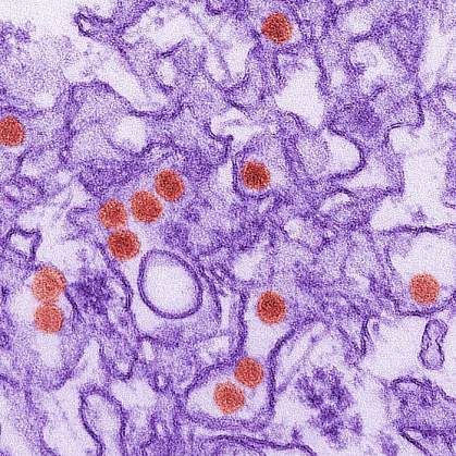 Zika virus Zika virus