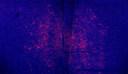 Brain neurons Brain neurons