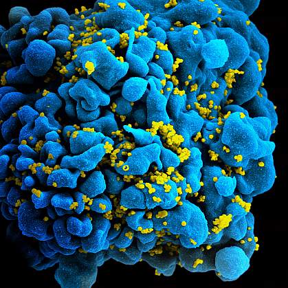 HIV-infected T cell HIV-infected T cell