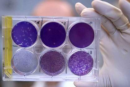 Researcher holding a tray of Zika virus growing in cells. Researcher holding a tray of Zika virus growing in cells.