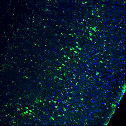 Neurons in adult mouse brain Neurons in adult mouse brain