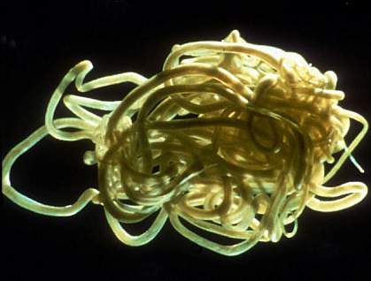 Onchocerca volvulus Onchocerca volvulus
