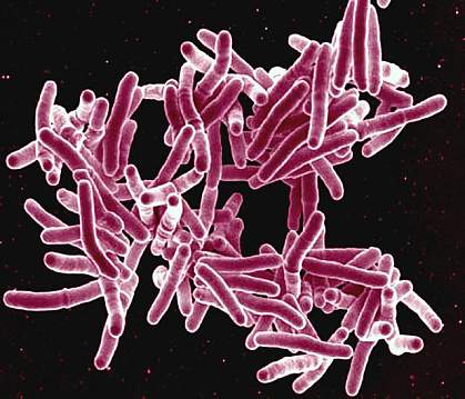 Mycobacterium tuberculosis. Mycobacterium tuberculosis.