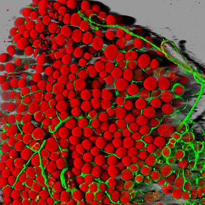 Fat cells and blood vessels Fat cells and blood vessels.