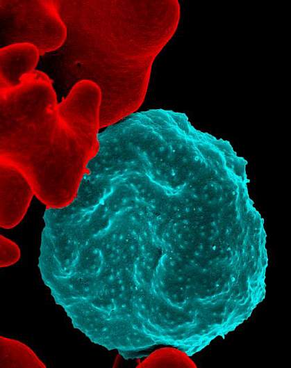 Malaria-infected red blood cell. Malaria-infected red blood cell.