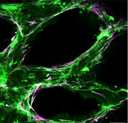 3-D printed blood vessels 3-D printed blood vessels