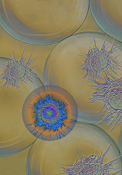 Illustration of macrophages Illustration of macrophage