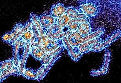 Colorized electron micrograph of Marburg virus. Colorized electron micrograph of Marburg virus.
