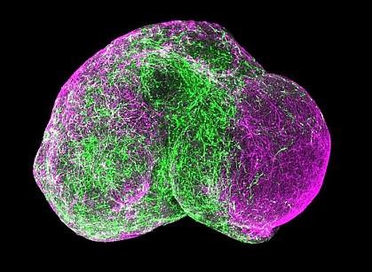 Fused forebrain spheroids Fused forebrain spheroids