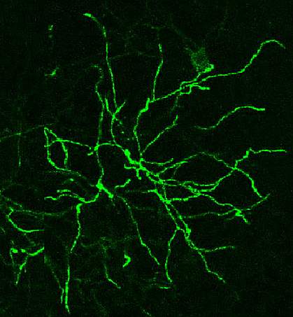 Neurons in the thalamus Confocal microscope image of neurons