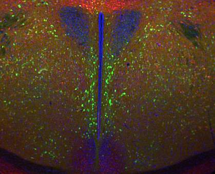 Mouse hypothalamus Mouse hypothalamus