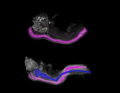 Reproductive tracts of female mouse embryos Reproductive tracts of female mouse embryos