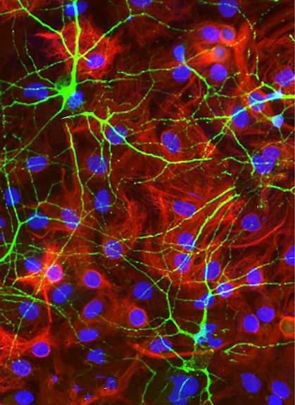 Microscopic image of brain cell culture Microscopic image of brain cell culture