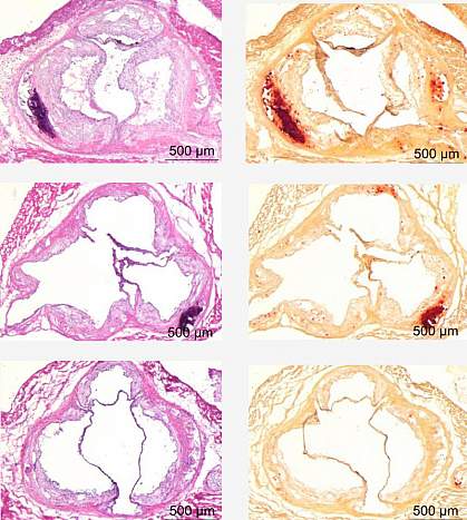 Calcification in aortic roots The aorta of a mouse fed a low-potassium diet has more calcification than that of a mouse mice fed a normal diet. The mouse fed a high-potassium diet has less calcification.