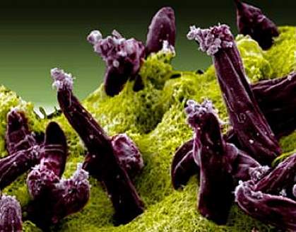 Plasmodium invading mosquito midgut Scanning electron micrograph of Plasmodium invading a mosquito midgut.