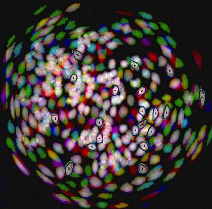 Neurons active in mouse brains Neurons active in mouse brains