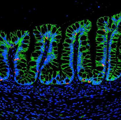 Human intestinal organoids in mouse intestine Human intestinal organoids in mouse intestine