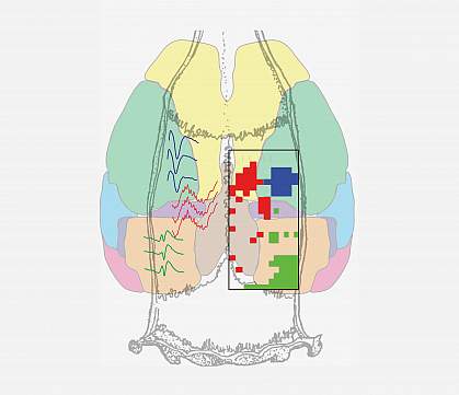 NeuroGrid map Anatomical map showing sample ripple traces color coded by brain region.