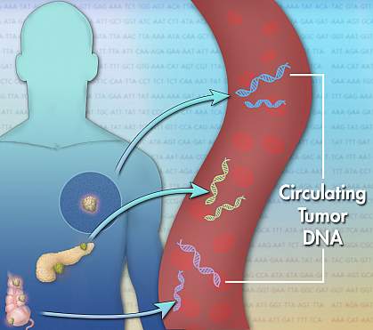 Circulating tumor DNA Illustration with arrows showing DNA moving from tumors into the bloodstream