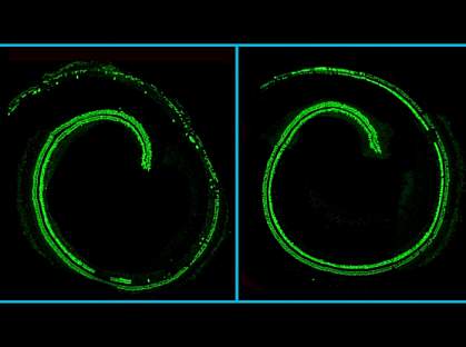 Confocal microscopy images of mouse cochlea.
