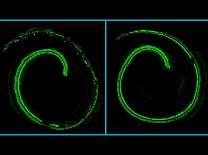 Confocal microscopy images of mouse cochlea Confocal microscopy images of mouse cochlea.