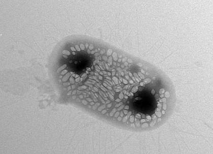 Transmission electron micrograph image of a genetically engineered E. coli bacterium. Transmission electron micrograph image of a genetically engineered E. coli bacterium.