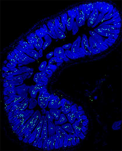 Microscopic image of IL-17 in the small intestine of a mouse Microscopic image of IL-17 in the small intestine of a mouse