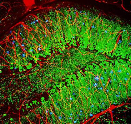 Mouse brain with hallmarks of Alzheimer’s disease Mouse brain with hallmarks of Alzheimer’s disease