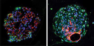 Lung organoids Lung organoids