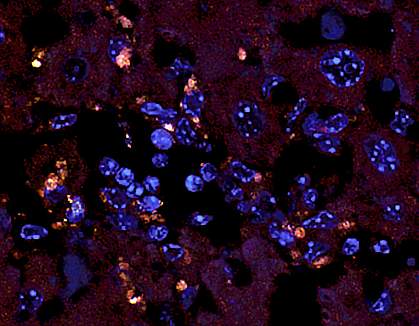 A microscopic image of liver tissue with bacteria A microscopic image of liver tissue with bacteria