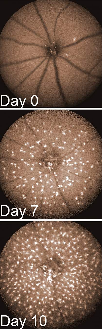 Three images of a retina show increasing number of immune cells on days 0, 7, and 10 Three images of a retina show increasing number of immune cells on days 0, 7, and 10