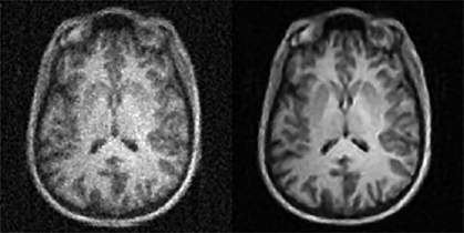 Brain images Brain images