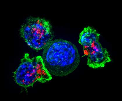 Killer T cells surrounding a cancer cell Killer T cells surrounding a cancer cell