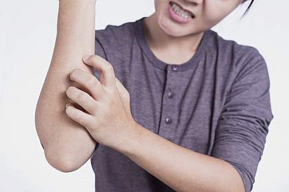 Woman scratching her arm Woman scratching her arm