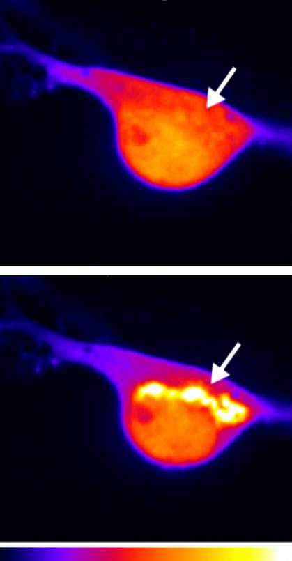 Micrographs of nerve cell Micrographs of nerve cell