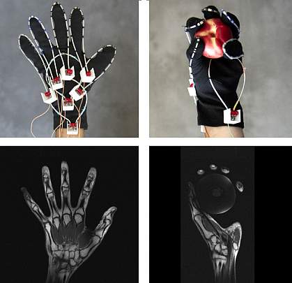 Photos of MRI glove on hand and MRI scans of the hand Photos of MRI glove on hand and MRI scans of the hand