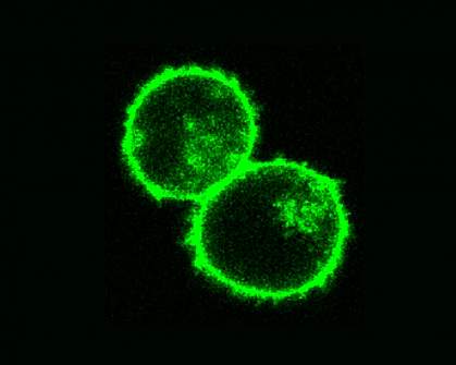Two T cells that have been altered by using CRISPR and electroporation. Two T cells that have been altered by using CRISPR and electroporation.