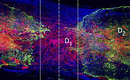 Microscope image of axons growing across a spinal cord injury Microscope image of axons growing across a spinal cord injury