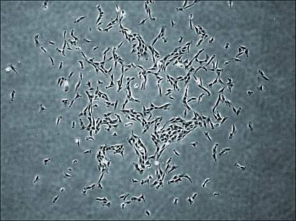 Human skeletal stem cells Human skeletal stem cells