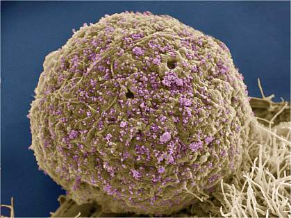 HIV-infected cell HIV-infected cell