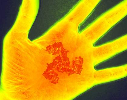 Image of a scan of a hand undergoing inflammation Image of a scan of a hand undergoing inflammation