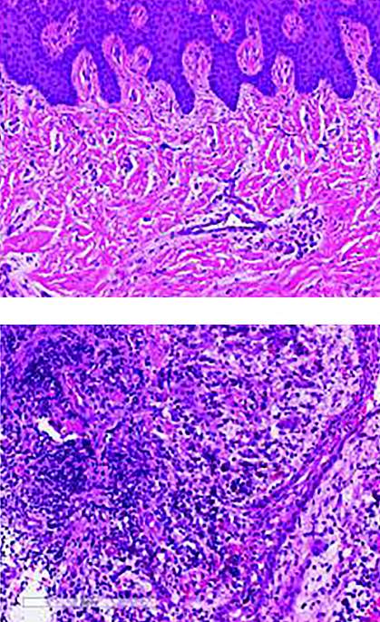 Histological images of gum tissue Histological images of gum tissue