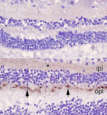 Two panel image of retinas