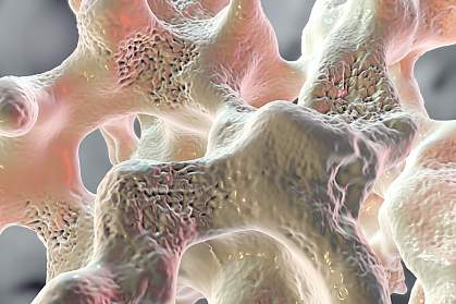 Spongy bone tissue Spongy bone tissue.